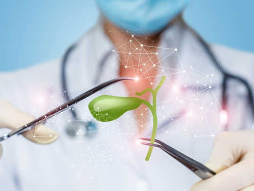 Colecistectomia: entenda como funciona a cirurgia de remoção da vesícula biliar